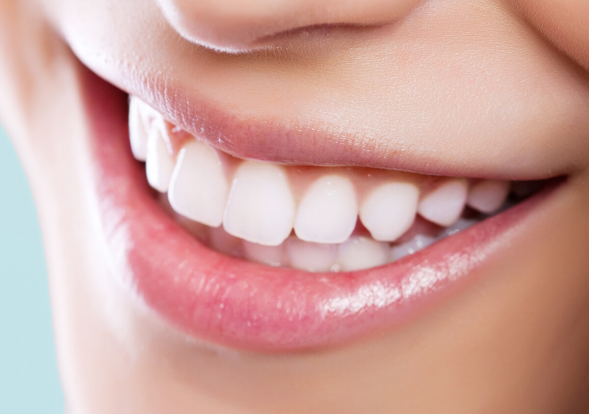 Dental Teeth Whitening in Petaluma CA Area Can Change Your Life
