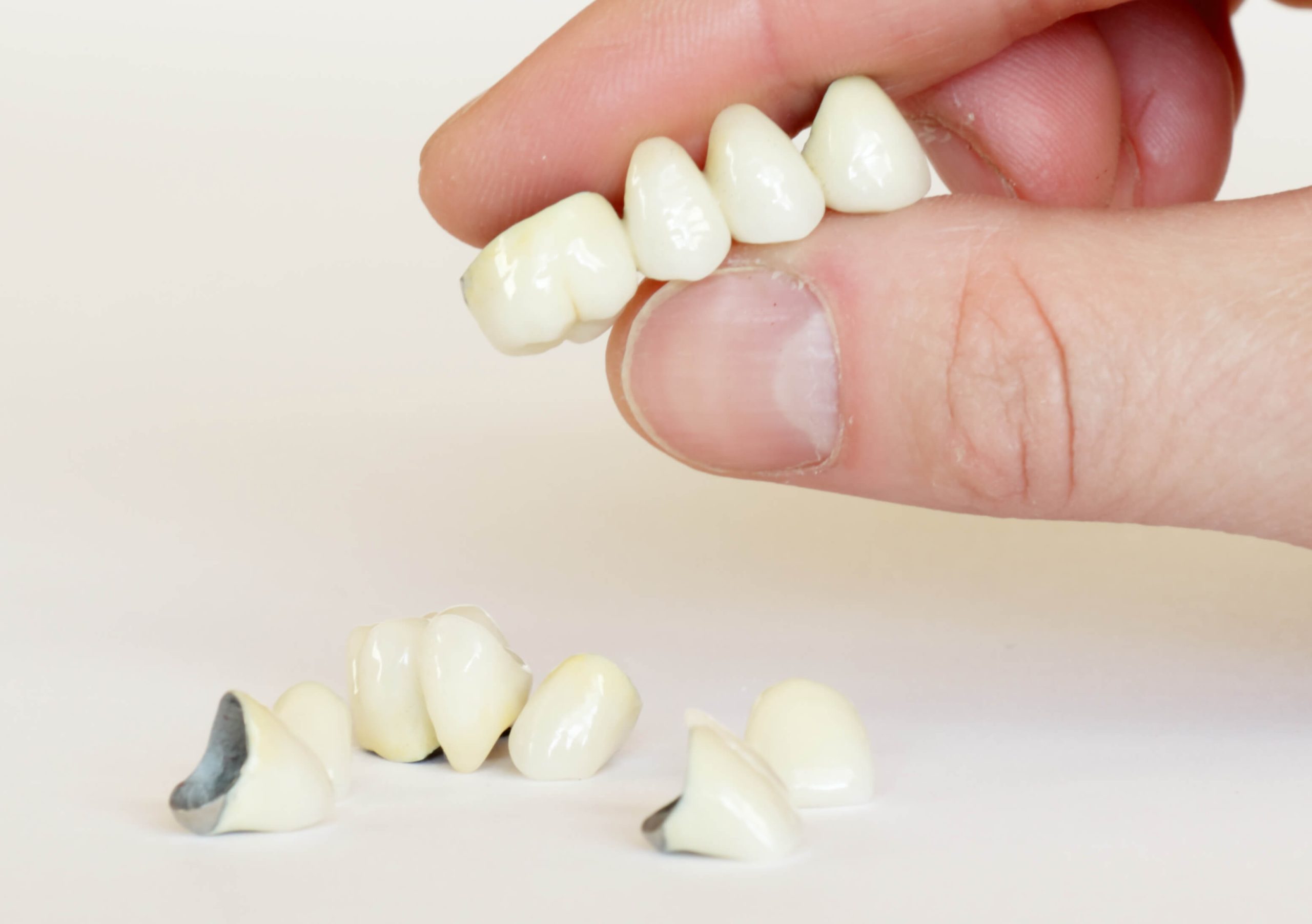 Missing Teeth? Teeth Bridges Can Complete Your Smile