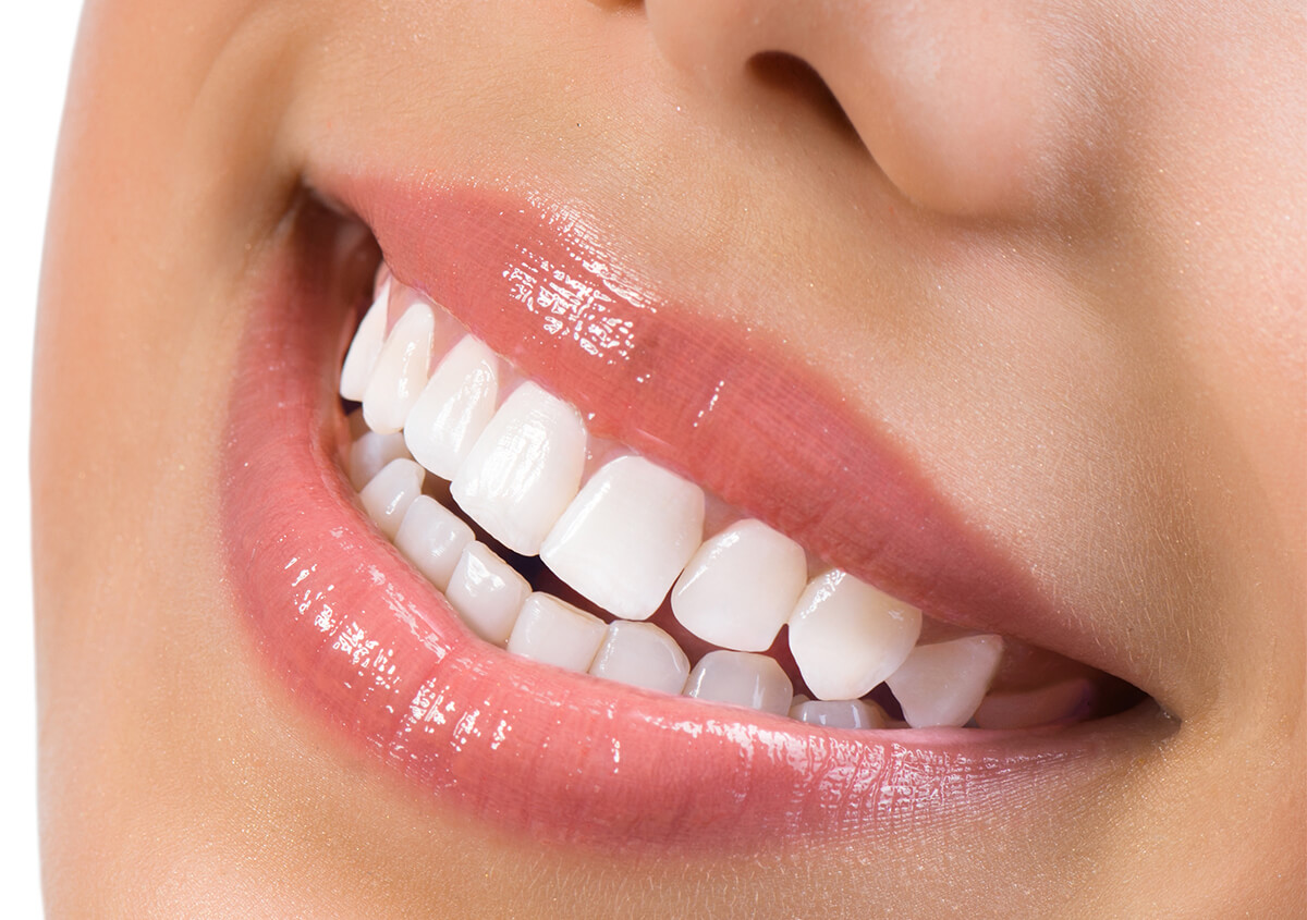Your Ticket to a Whiter Smile with Professional Teeth Whitening