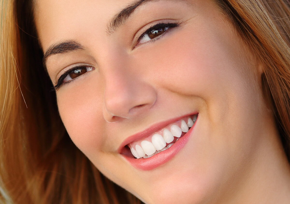 Sealant for Prevent Teeth Cavities in Petaluma CA Area